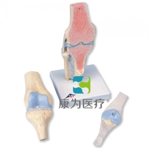 膝關節(jié)截面模型，3部分
