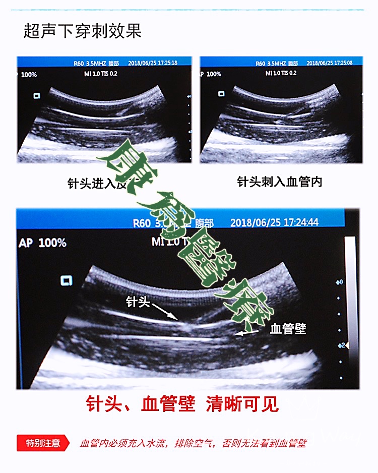 “康為醫(yī)療”超聲引導(dǎo)下血管穿刺訓(xùn)練模塊